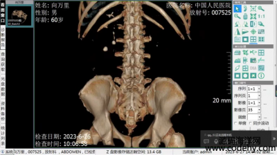 8891-PACStWӰ惦͂ݔϵy tWӰ惦͂ݔϵyDR CT MR DSA