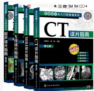 8897-ӰxƬTͨϵеڶ桿ڰ׸Ӱpdf 4